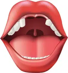 clobetasolo lichen planus afte